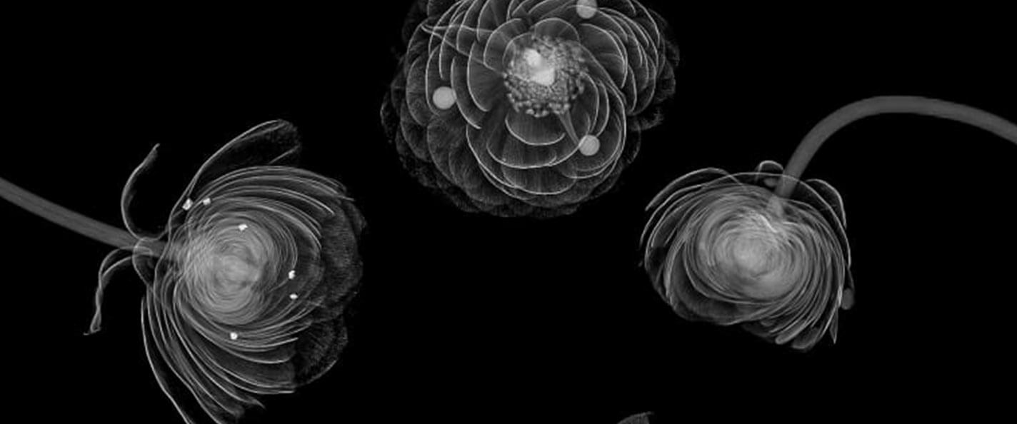 An X-ray of flowers dotted with calcium deposits.