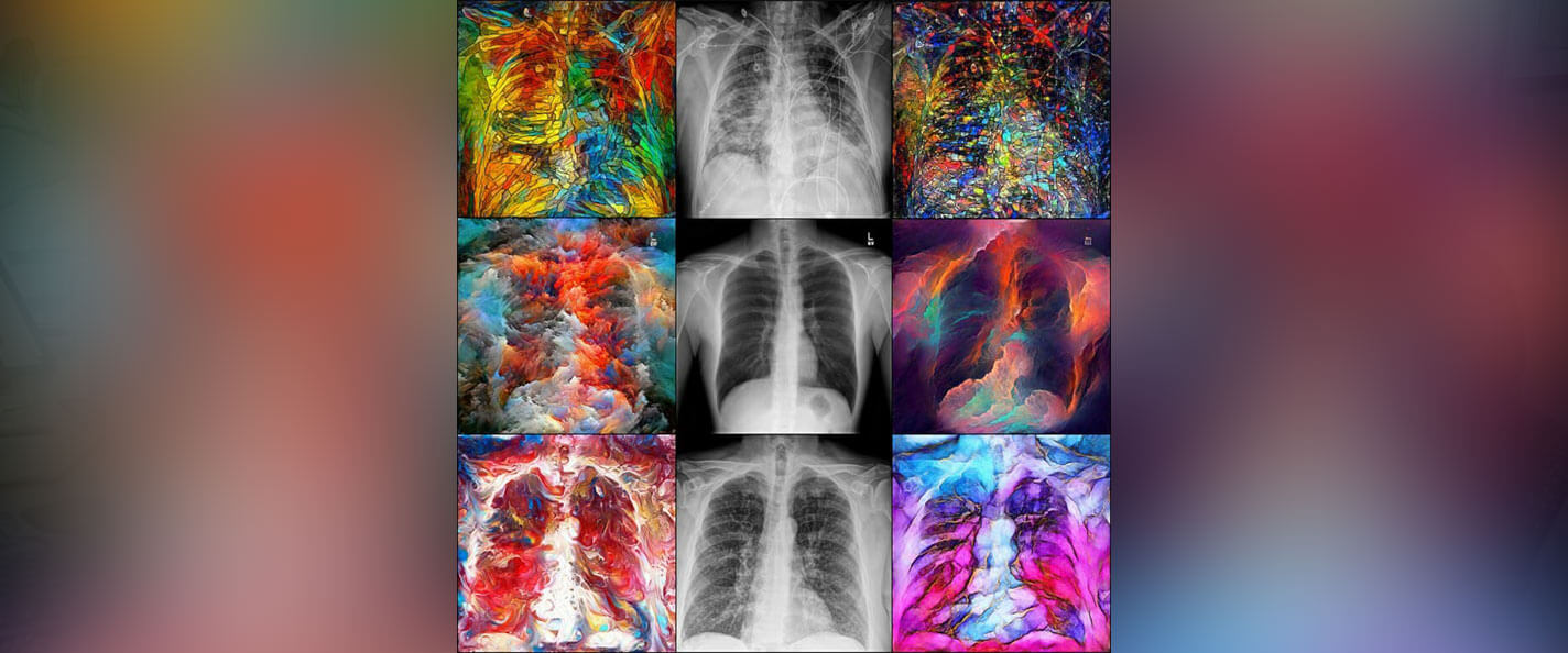 X-rays of lungs laid out in a grid.