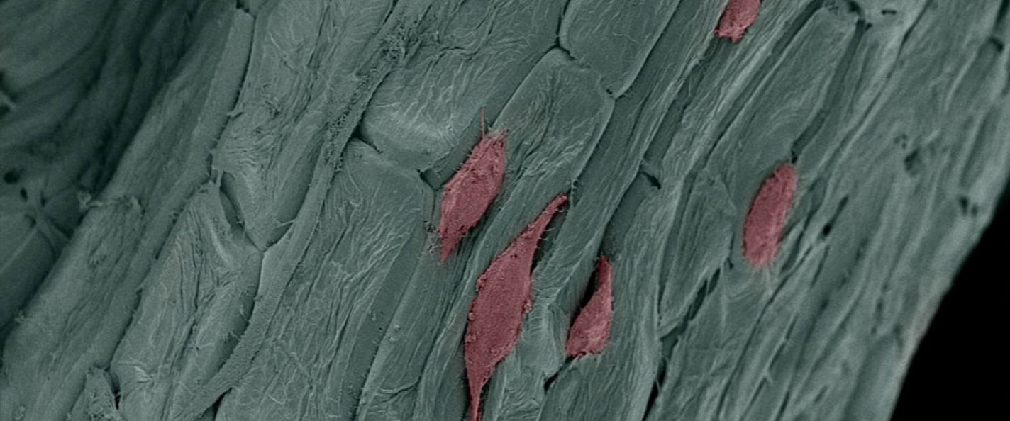 Human fibroblast cells embedded in parsley scaffolding.